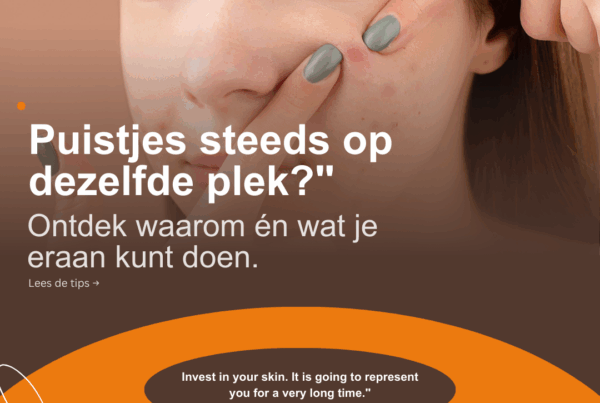 Altijd een puist op dezelfde plek? Dit is waarom – en wat je eraan kunt doen, Skin & Care