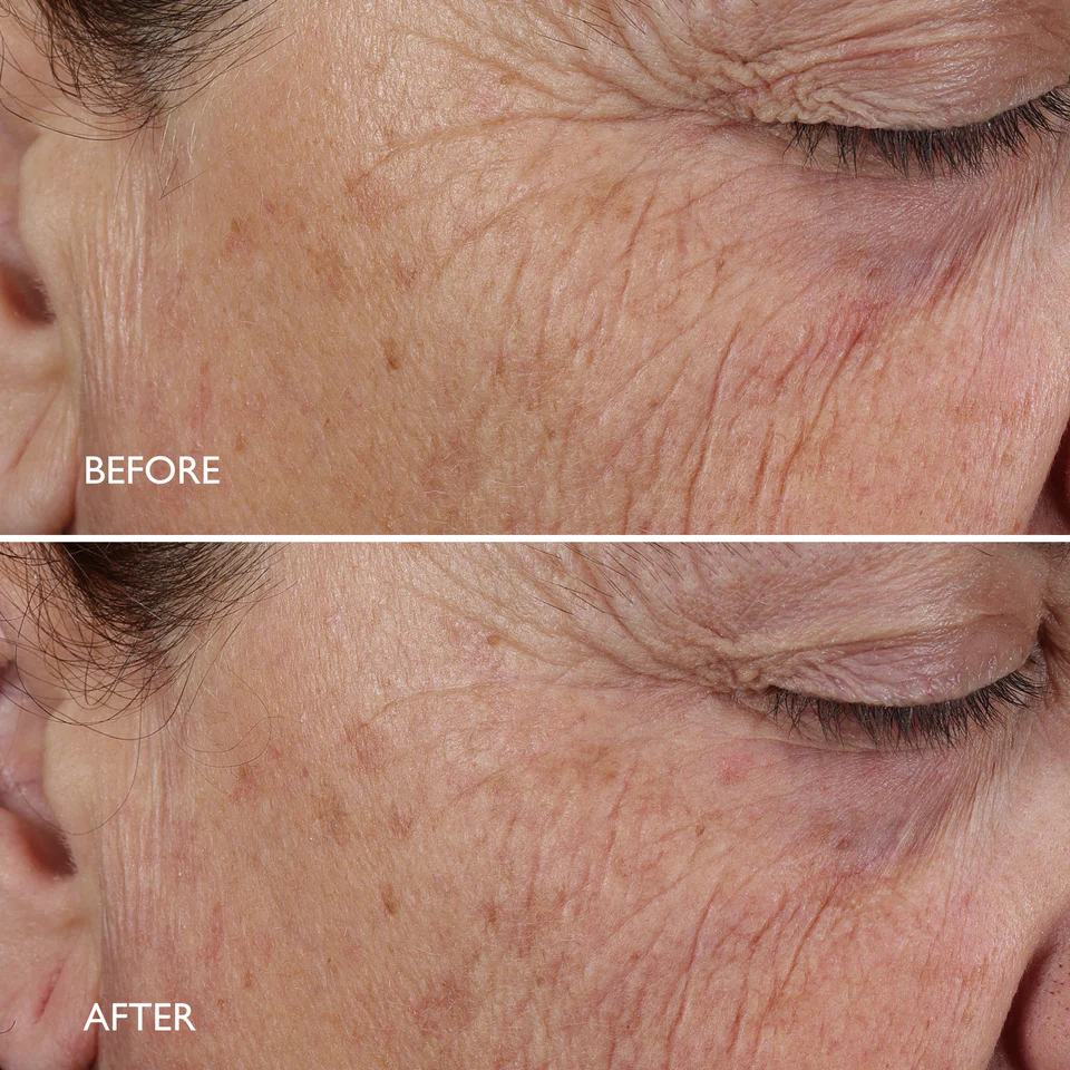 Gatineau Age Benefit Night Renewal Cream_SkinCare_Voor_en_na